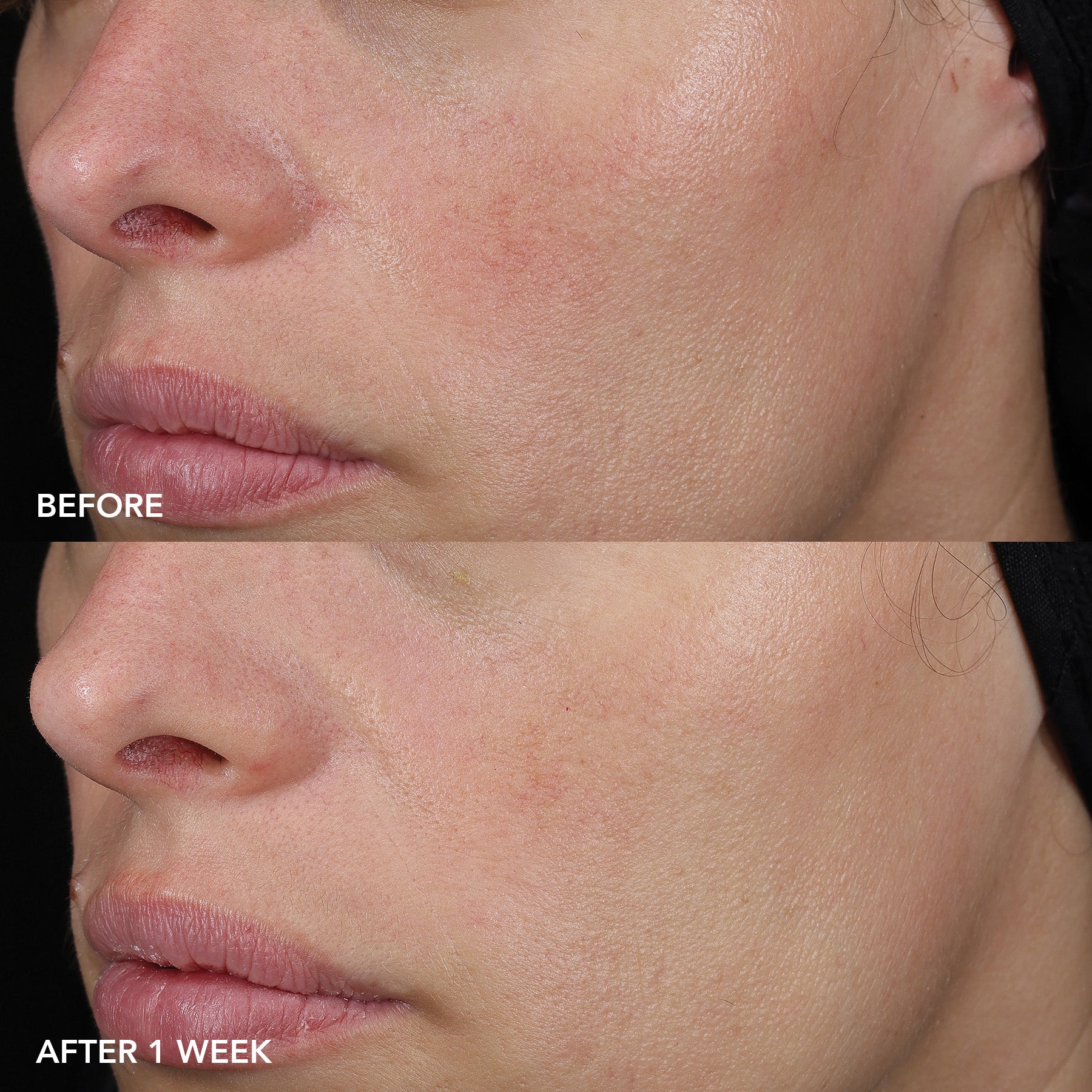 IMAGE MD® barrier repair recovery balm 6 IMAGE MD® barrier repair recovery balm