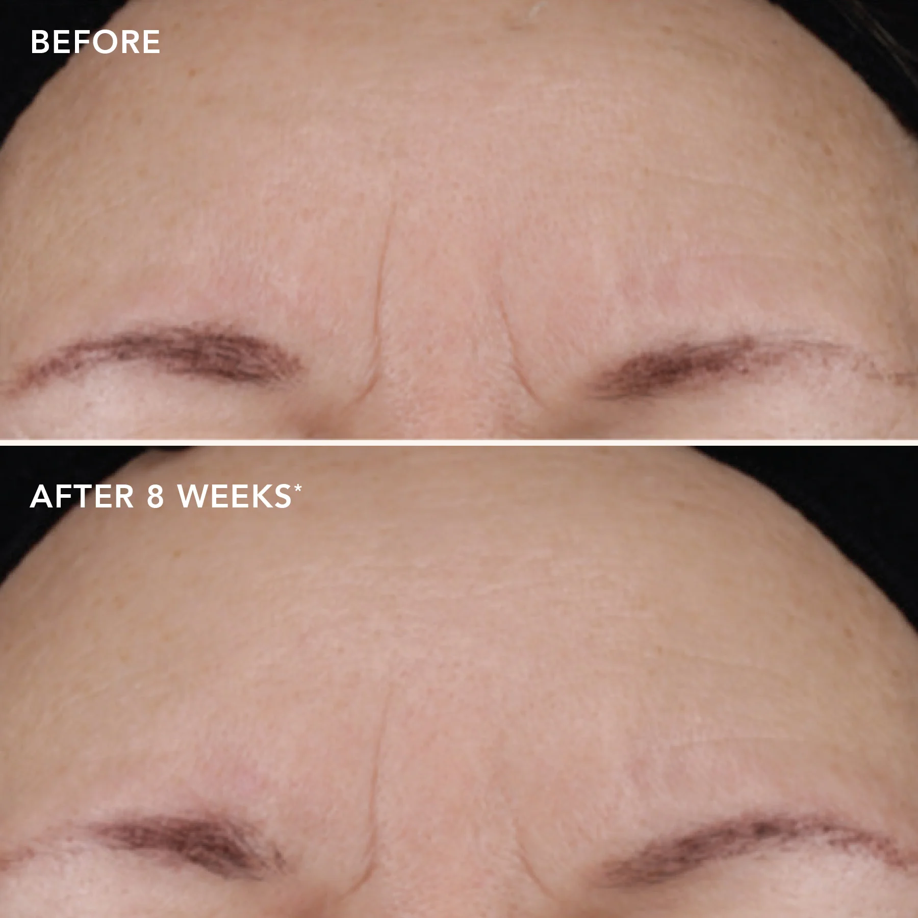 AGELESS+ retinol treatment crème 1.2% retinol complex 4 AGELESS+ retinol treatment crème 1.2% retinol complex