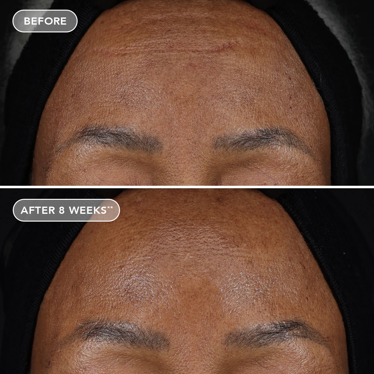 AGELESS+ retinol treatment crème 1.2% retinol complex 5 AGELESS+ retinol treatment crème 1.2% retinol complex