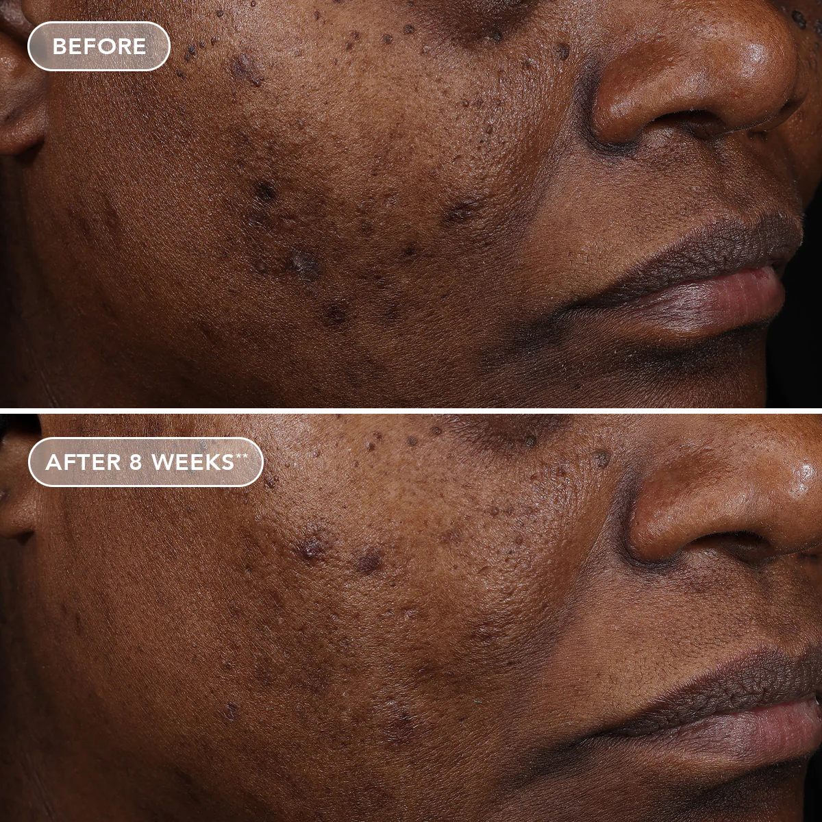 AGELESS+ retinol treatment crème 1.2% retinol complex 6 AGELESS+ retinol treatment crème 1.2% retinol complex