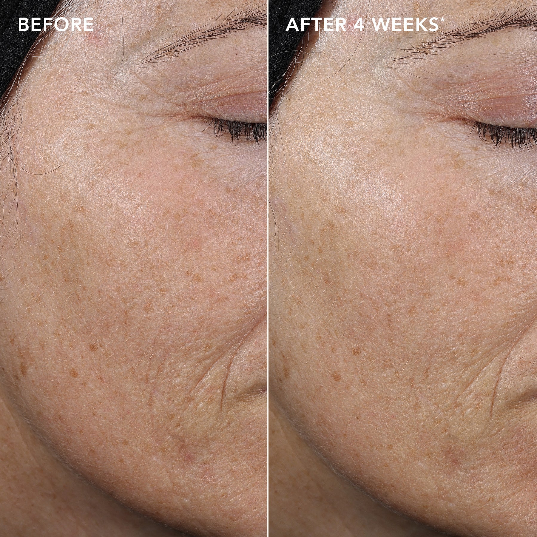 AGELESS+ retinol pure liquid retinol 0.3% 4 AGELESS+ retinol pure liquid retinol 0.3%