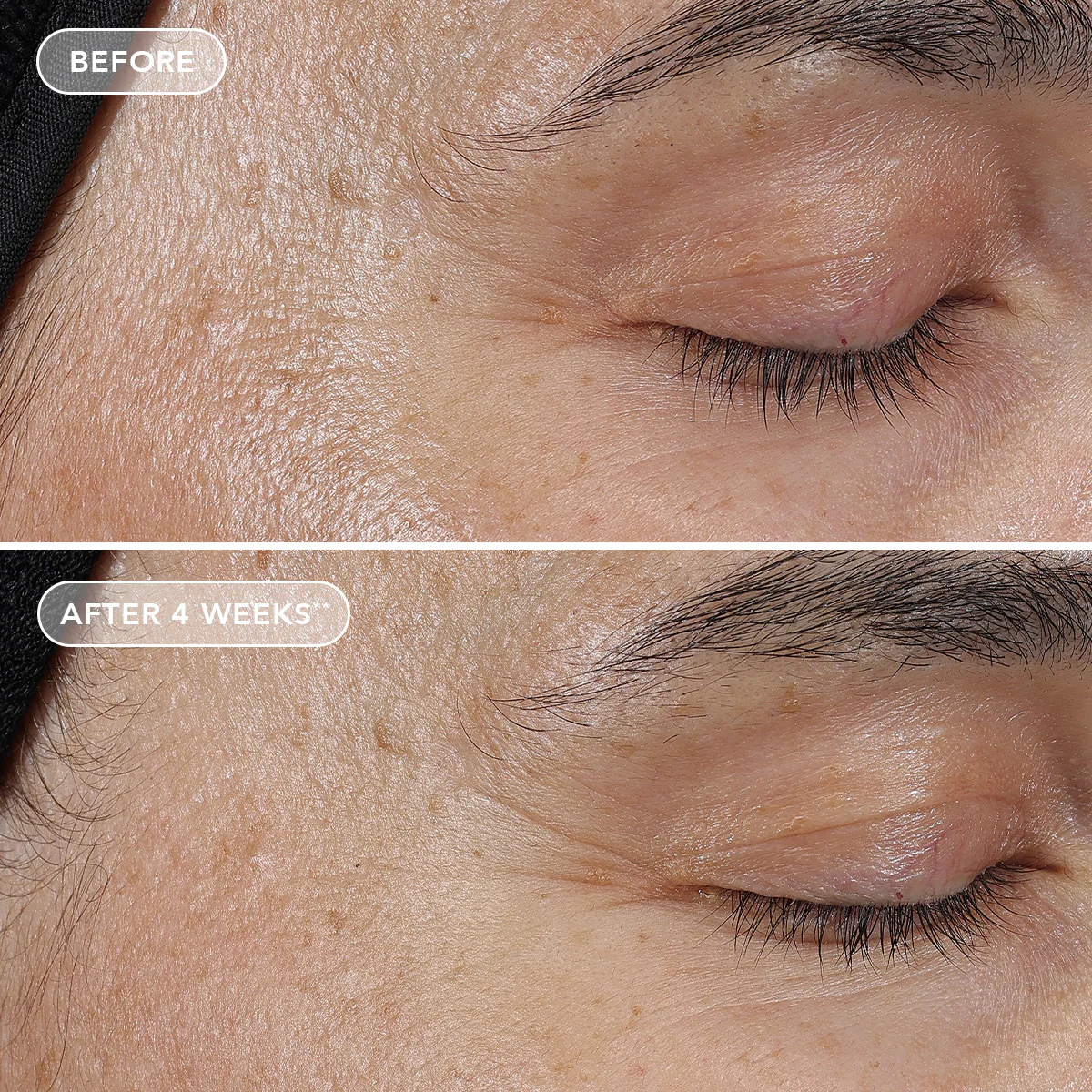 AGELESS+ retinol pure liquid retinol 0.3% 5 AGELESS+ retinol pure liquid retinol 0.3%