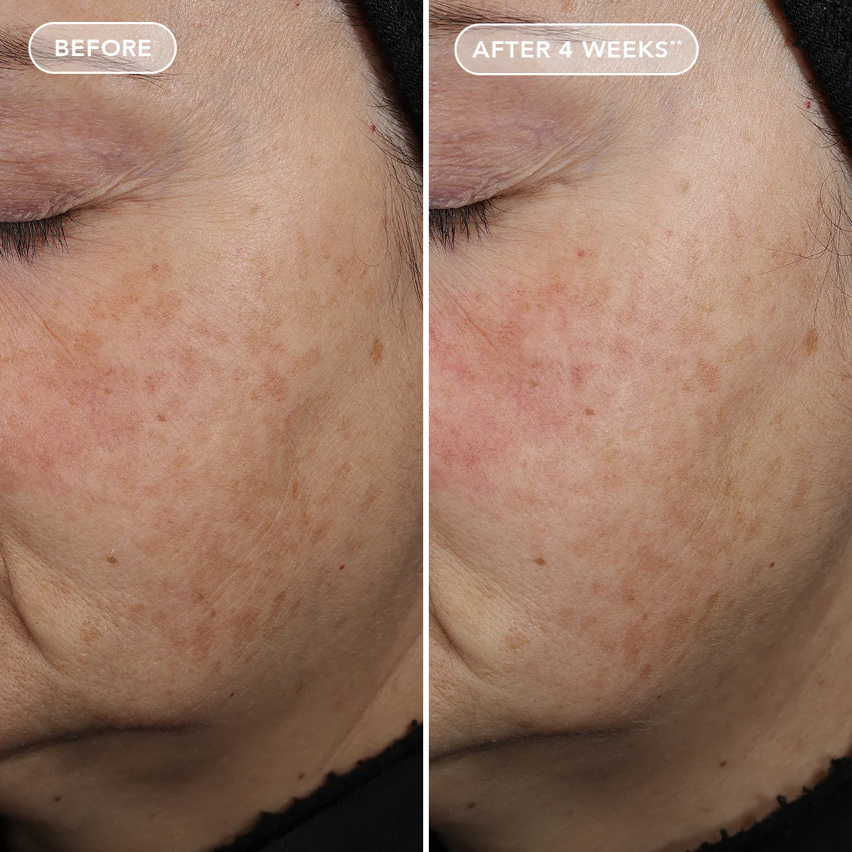 AGELESS+ retinol pure liquid retinol 0.3% 6 AGELESS+ retinol pure liquid retinol 0.3%