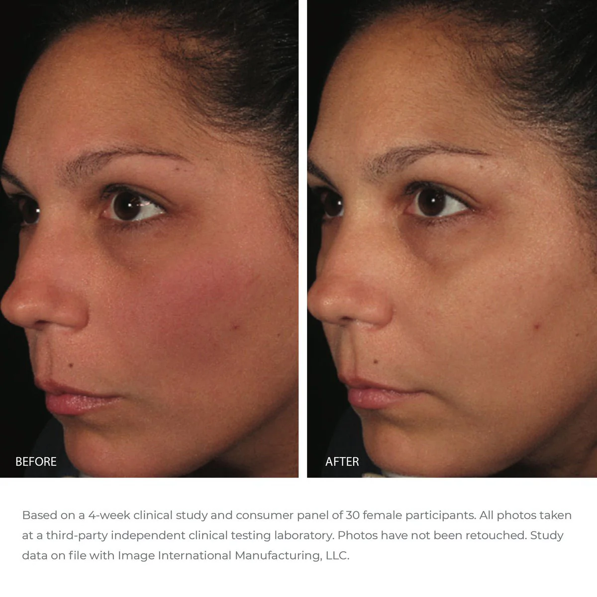 ORMEDIC balancing antioxidant serum 2 ORMEDIC balancing antioxidant serum