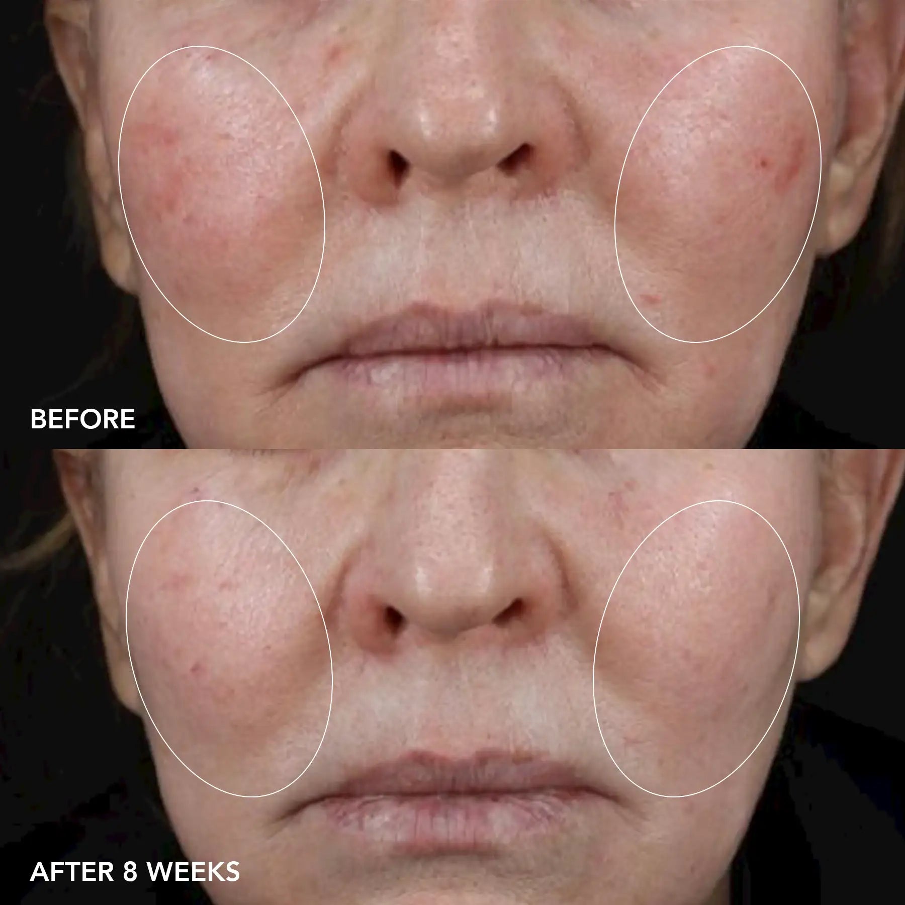 IMAGE MD® biotech longevity creme 5 IMAGE MD® biotech longevity creme